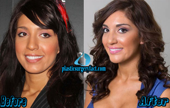 Farrah Abraham Plastic Surgery Before And After Breast Implants And Office Girls Wallpaper