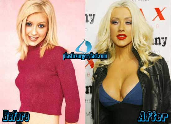 Christina agulara breast implants