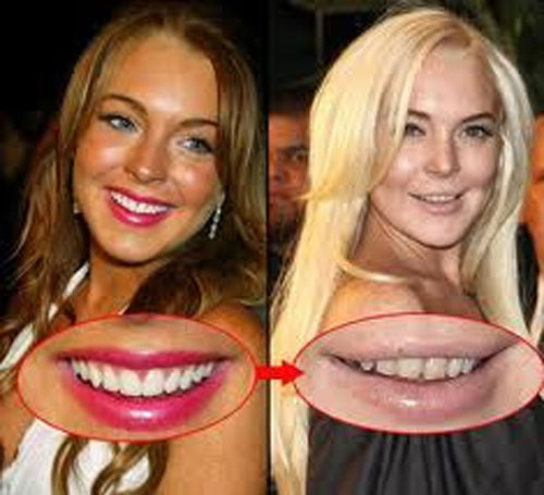 lindsay lohan before and after