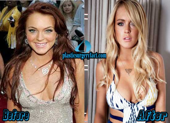 lindsay lohan before and after