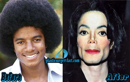 michael jackson before and after