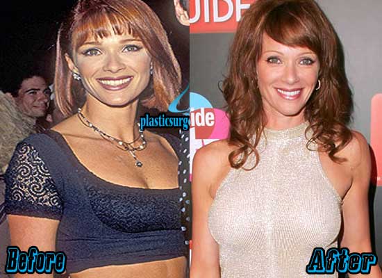 Lauren Holly Denies Plastic Surgery Rumours And Discusses Jim