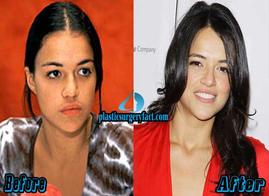 Michelle Rodriguez Plastic Surgery Before And After 