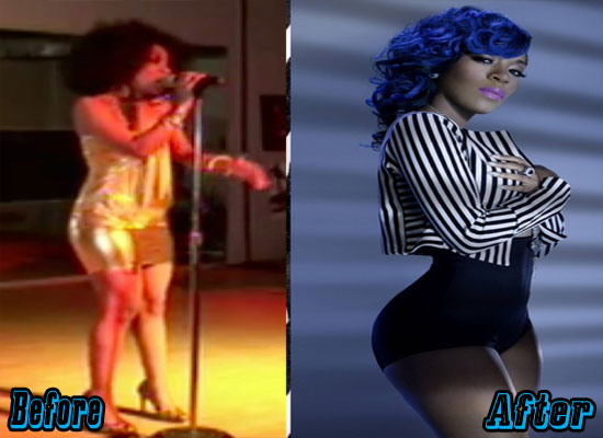 k michelle before and after