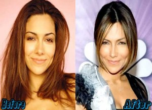 Vanessa Marcil Plastic Surgery Before And After Plastic Surgery Facts