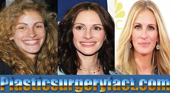 Julia Roberts Plastic Surgery Before And After