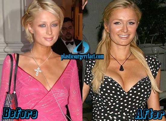 Paris Hilton Boob 82