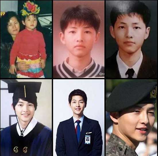 Song Joong Ki Plastic Surgery Before and After Photos