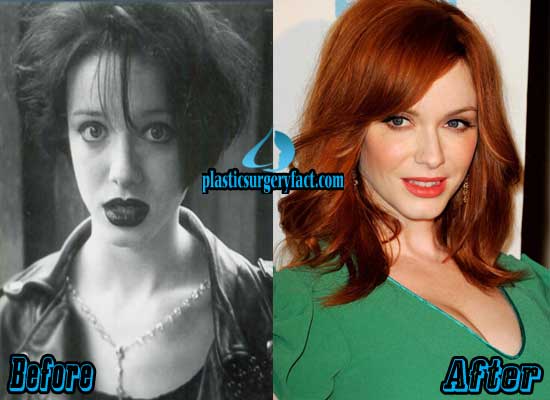 christina hendricks nose job