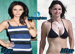 Courteney Cox Plastic Surgery Before and After Photos
