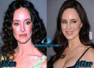 Madeleine Stowe Plastic Surgery Before and After Photos - Plastic ...