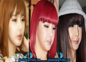 Park Bom Plastic Surgery Before and After Photos – Plastic Surgery Facts