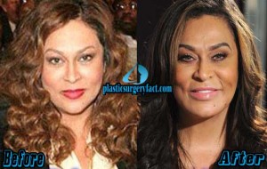Tina Knowles Plastic Surgery Before and After Photos
