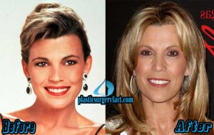 Vanna White Plastic Surgery Before and After Photos