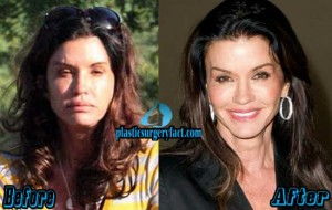 Janice Dickinson Plastic Surgery Before And After Photos - Plastic 