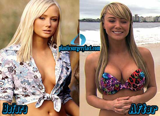 Sara Jean Underwood Plastic Surgery Before and After Picture