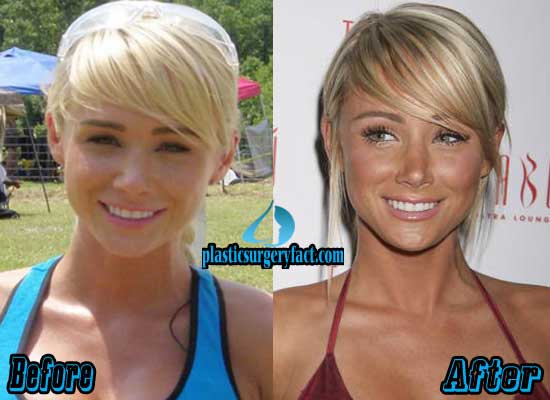 drikke beskyttelse Koncentration Sara Jean Underwood Plastic Surgery Before and After Pictures - Plastic  Surgery Facts