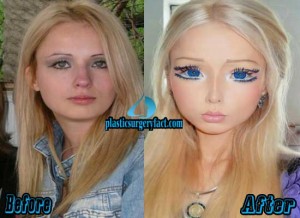 Barbie Woman Plastic Surgery Before and After Photos - Plastic Surgery ...