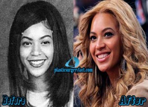 Beyonce Plastic Surgery Before and After Photos