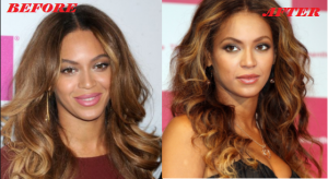 Beyonce Plastic Surgery Before and After Photos