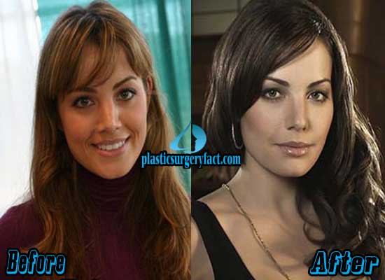 Erica Durance Plastic Surgery Before and After Pictures