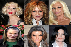 Pictures of Plastic Surgery Gone Wrong