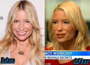 Tracy Anderson Plastic Surgery Before and After - Plastic Surgery Facts