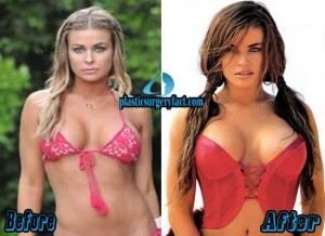 10 Best Boob Jobs In Hollywood Before and After Photos