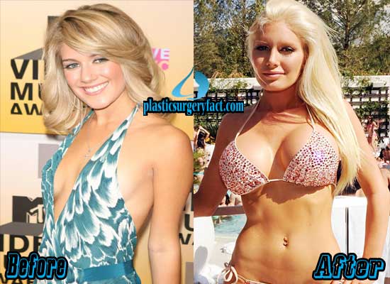 10 Best Boob Jobs In Hollywood Before And After Photos Plastic Surgery Facts