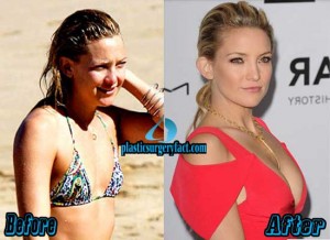 10 Best Boob Jobs In Hollywood Before and After Photos