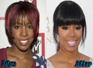 Kelly Rowland Nose Job Before And After - Plastic Surgery Facts