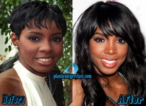 Kelly Rowland Nose Job Before And After - Plastic Surgery Facts