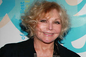 Kim Novak Plastic Surgery