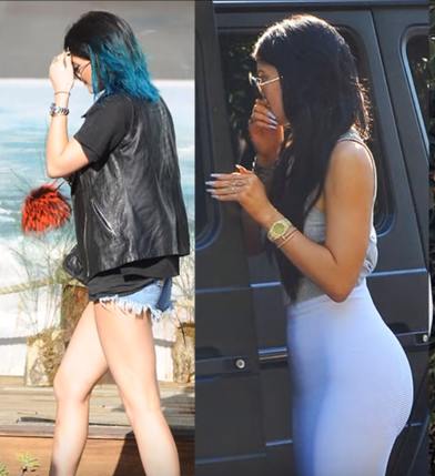 Kylie Jenner butt implants