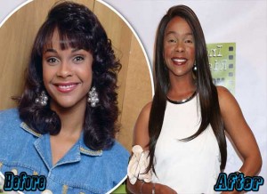 Lark Voorhies Plastic Surgery Before and After - Plastic Surgery Facts