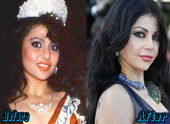 Haifa Wehbe Plastic Surgery Before and After.