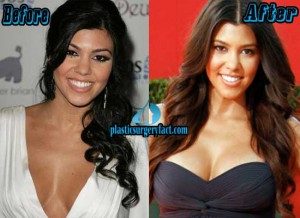 Kourtney Kardashian Plastic Surgery Before and After