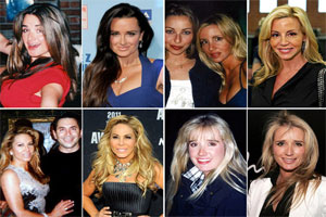 Real Housewives of Beverly Hills Plastic Surgery