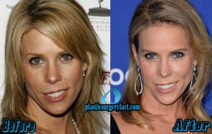 Cheryl Hines Plastic Surgery Before After Defends