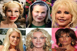 Botched Plastic Surgery Photos