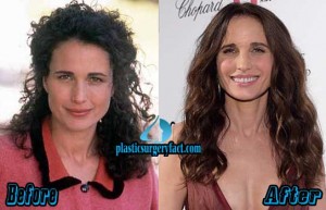 Andie Macdowell Plastic Surgery Before And After - Plastic Surgery Facts