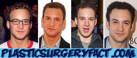 Ben Savage Girl Meets World Nose