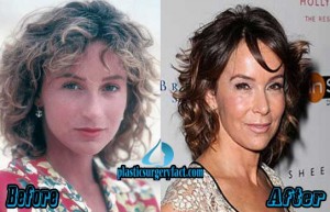 Jennifer Grey Nose Job- Jennifer Grey Before and After Nose Job