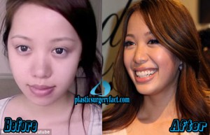 Michelle Phan Nose Job- Is Michelle Phan Nose Job Fact or Makeup ...