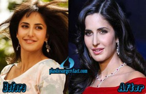 Katrina Kaif Plastic Surgery Before and After Photos - Plastic Surgery