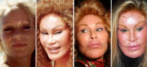 CatWomen Plastic Surgery Jocelyn Wildenstein Gone Wrong - Plastic ...