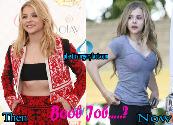 Eles fazem com que tu duvides de ti”. Chloe Grace Moretz revela que  ponderou colocar silicone