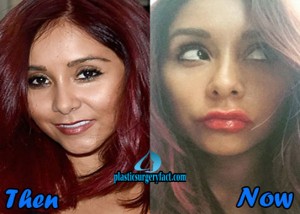 Celebrity Plastic Surgery Before After 2016: Shocking Confession!