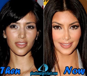 Celebrity Plastic Surgery Before After 2016: Shocking Confession!