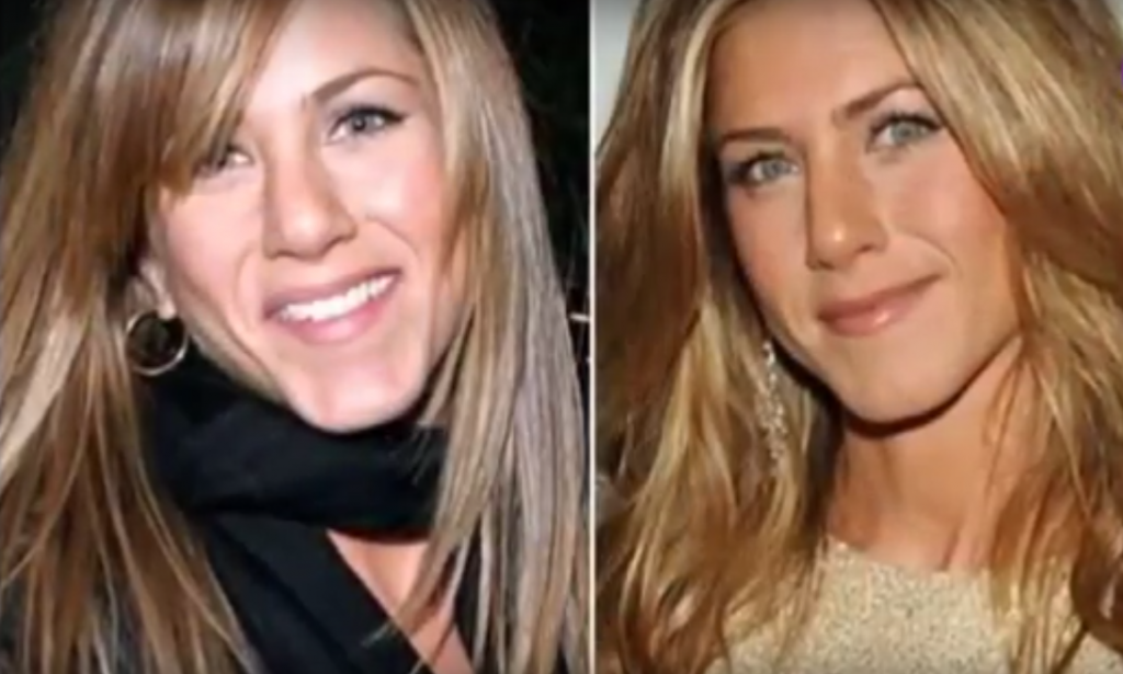Jennifer Aniston Plastic Surgery Before and After Plastic Surgery Facts